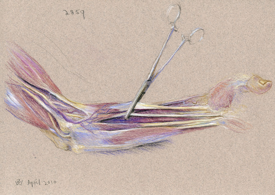 Left Forearm (Study for 'Dr Freeman's Anatomy Lesson'), 2010, pastel drawing by Australian artist Susan Dorothea White 