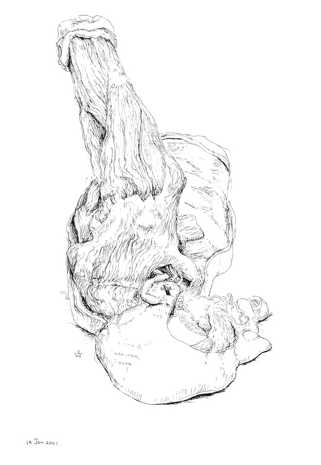 Torso Specimen with Abducted Arm (superior view; left)